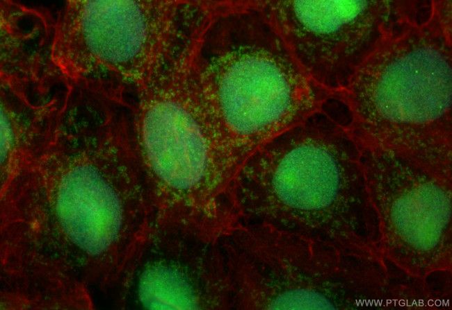 C22orf32 Antibody in Immunocytochemistry (ICC/IF)