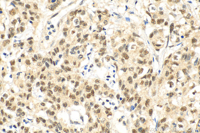METTL3 Antibody in Immunohistochemistry (Paraffin) (IHC (P))