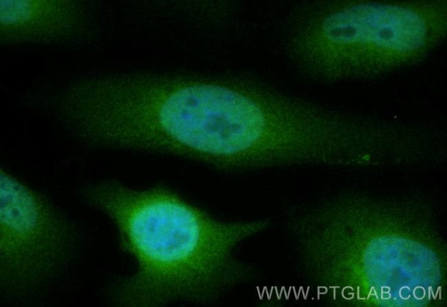 CDCA5 Antibody in Immunocytochemistry (ICC/IF)