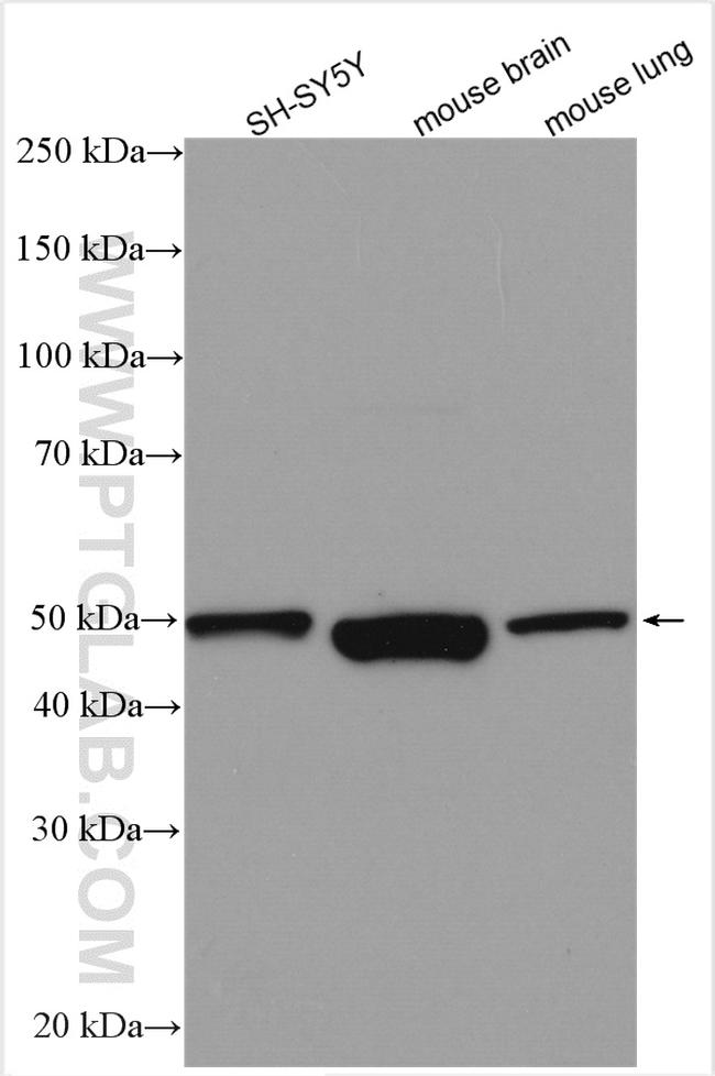 S1PR1 Antibody in Western Blot (WB)