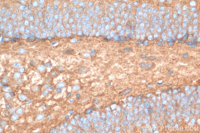 NLGN3 Antibody in Immunohistochemistry (Paraffin) (IHC (P))
