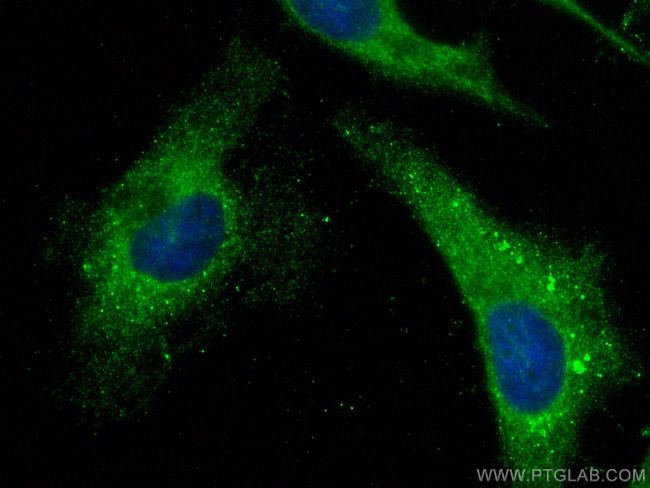 SPATA2 Antibody in Immunocytochemistry (ICC/IF)