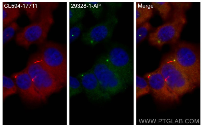 GPR161 Antibody in Immunocytochemistry (ICC/IF)