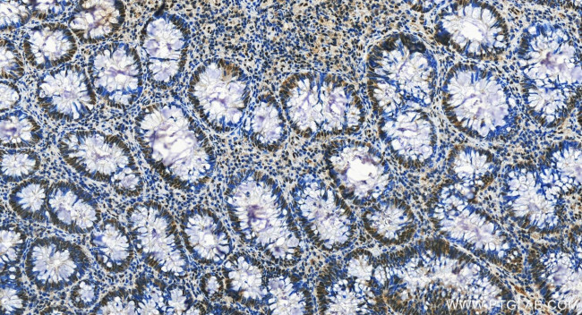 FOXK1 Antibody in Immunohistochemistry (Paraffin) (IHC (P))