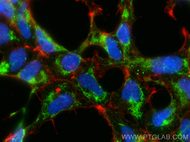 ND3 Antibody in Immunocytochemistry (ICC/IF)