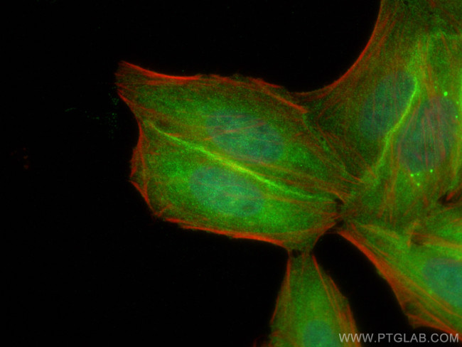 HDAC5 Antibody in Immunocytochemistry (ICC/IF)