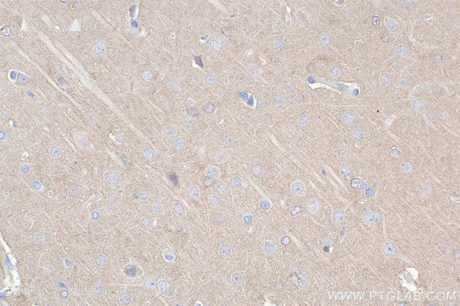 ABR Antibody in Immunohistochemistry (Paraffin) (IHC (P))
