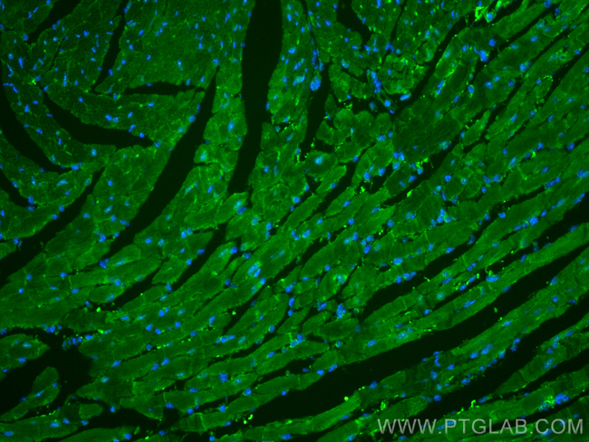 NPPC Antibody in Immunohistochemistry (Paraffin) (IHC (P))