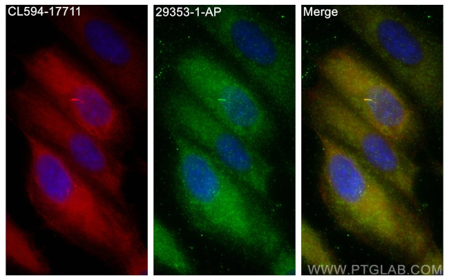 INPP5E Antibody in Immunocytochemistry (ICC/IF)