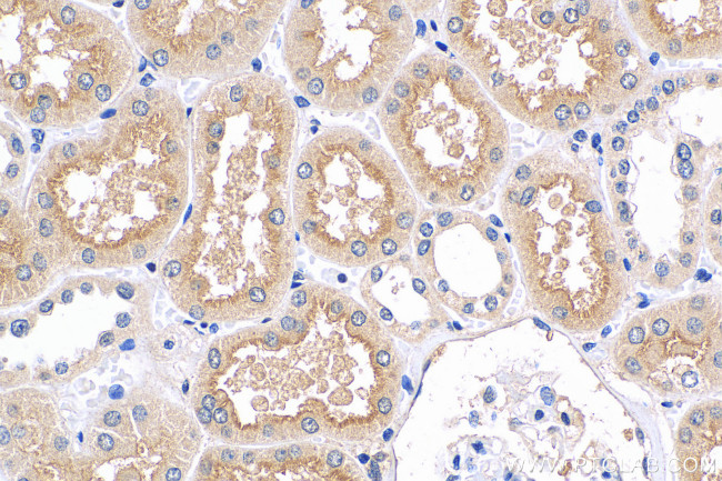 SLC6A19 Antibody in Immunohistochemistry (Paraffin) (IHC (P))