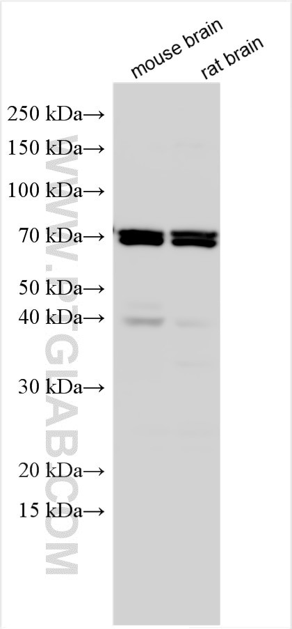 IDS Antibody in Western Blot (WB)