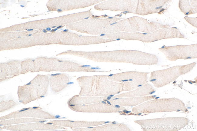 LMO7 Antibody in Immunohistochemistry (Paraffin) (IHC (P))