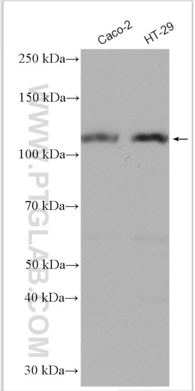 DPP4/CD26 Antibody in Western Blot (WB)