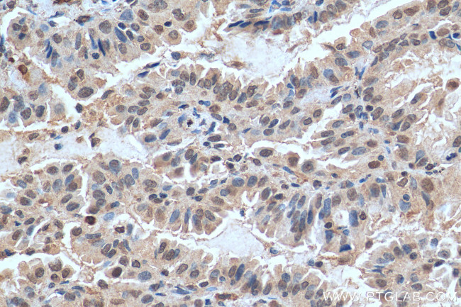 FAM111B Antibody in Immunohistochemistry (Paraffin) (IHC (P))
