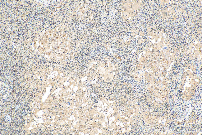 UBQLN4 Antibody in Immunohistochemistry (Paraffin) (IHC (P))