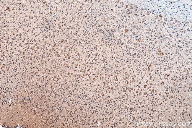 PTPRS Antibody in Immunohistochemistry (Paraffin) (IHC (P))