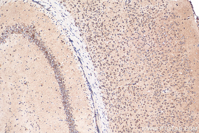 NHLRC2 Antibody in Immunohistochemistry (Paraffin) (IHC (P))