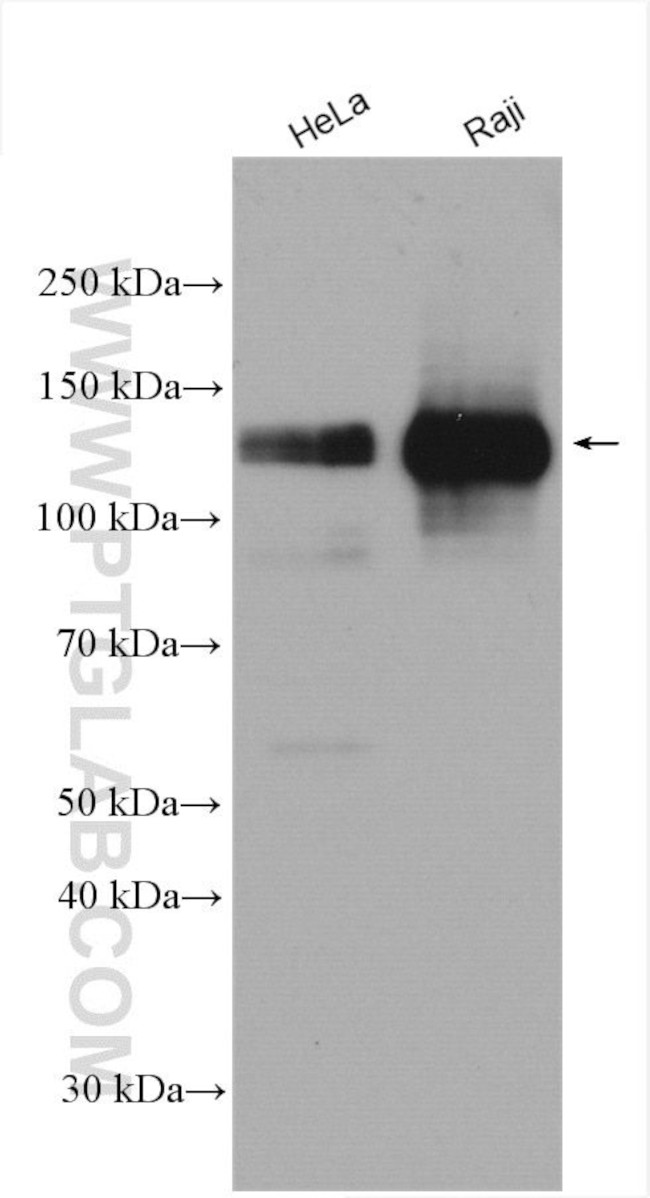 INCENP Antibody in Western Blot (WB)
