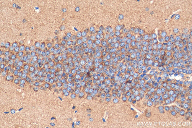 PLXNB1 Antibody in Immunohistochemistry (Paraffin) (IHC (P))