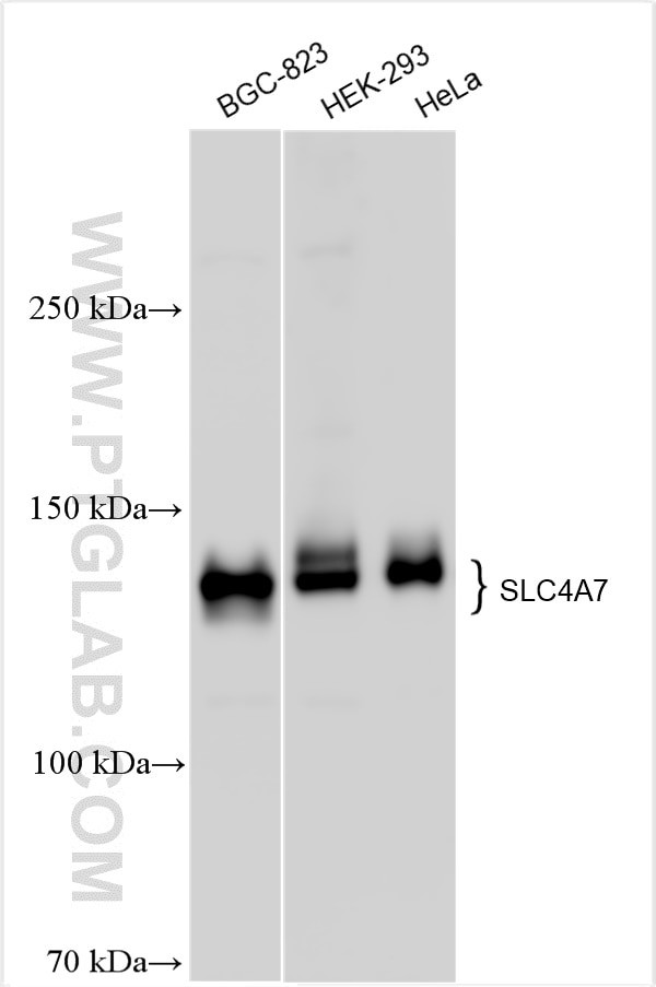 NBCn1 Antibody in Western Blot (WB)