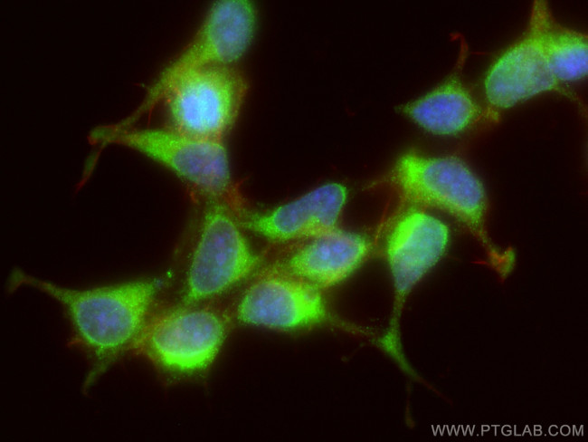 ATG16L1 Antibody in Immunocytochemistry (ICC/IF)