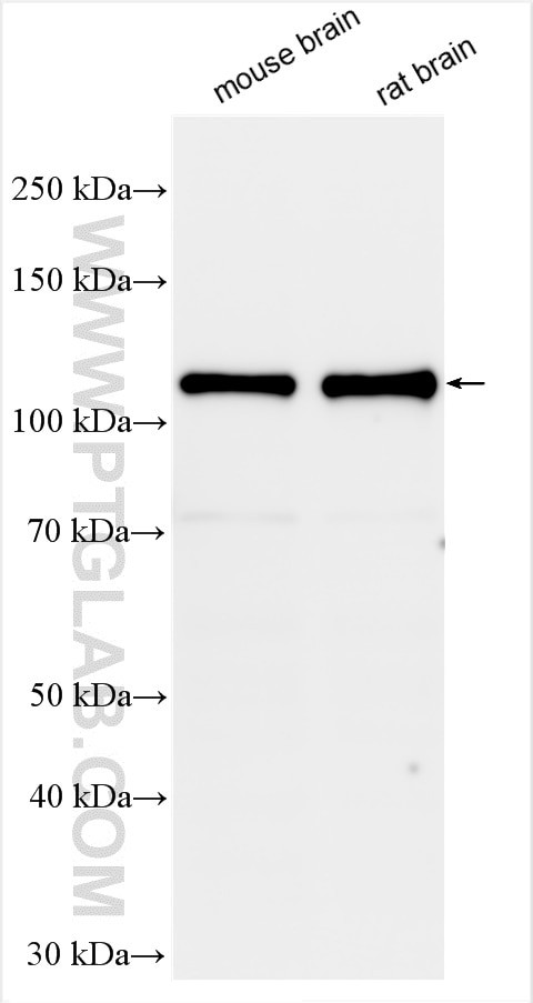 DLG2 Antibody in Western Blot (WB)