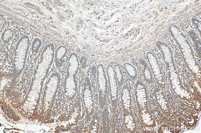 ERAL1 Antibody in Immunohistochemistry (Paraffin) (IHC (P))