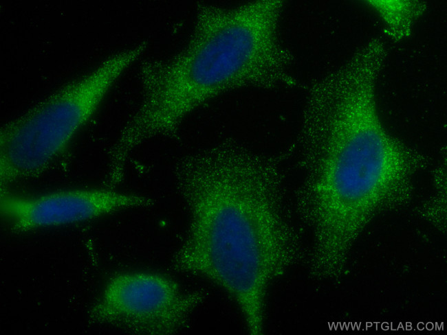 HHIP Antibody in Immunocytochemistry (ICC/IF)