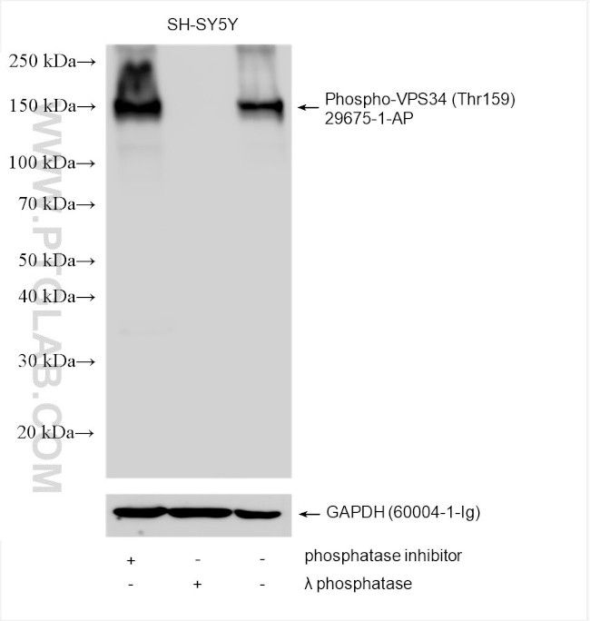 VGLUT1 Antibody in Western Blot (WB)