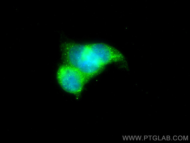PLOD1 Antibody in Immunocytochemistry (ICC/IF)