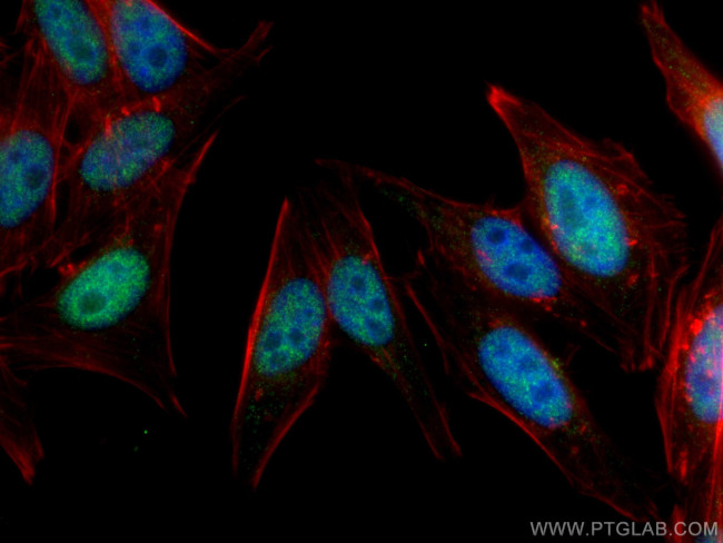 INO80B Antibody in Immunocytochemistry (ICC/IF)