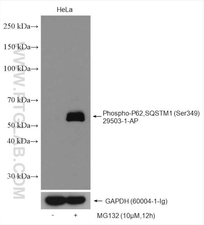 Phospho-P62/SQSTM1 (Ser349) Antibody in Western Blot (WB)