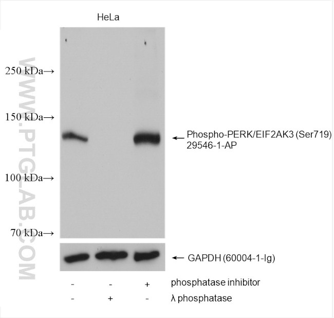 Phospho-PERK/EIF2AK3 (Ser719) Antibody in Western Blot (WB)
