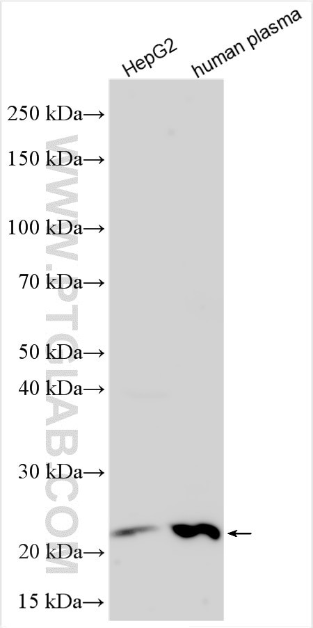 RBP4 Antibody in Western Blot (WB)