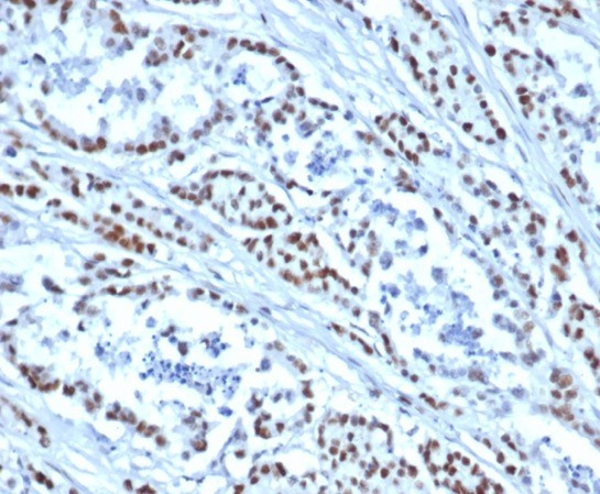 MSH6 (DNA Mismatch Repair Protein) Antibody in Immunohistochemistry (Paraffin) (IHC (P))