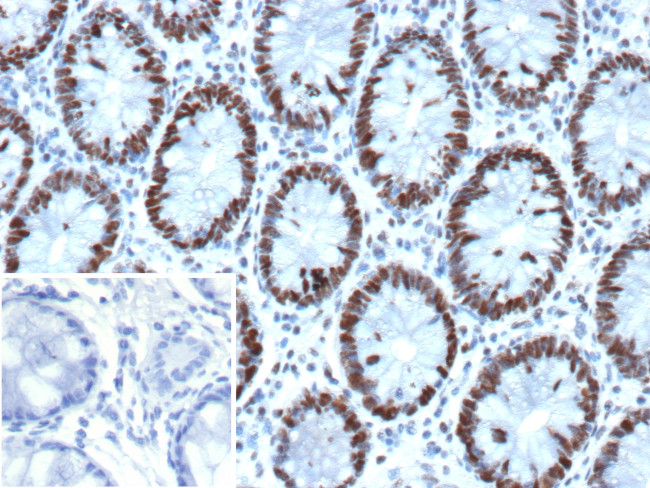 MSH6 (DNA Mismatch Repair Protein) Antibody in Immunohistochemistry (Paraffin) (IHC (P))