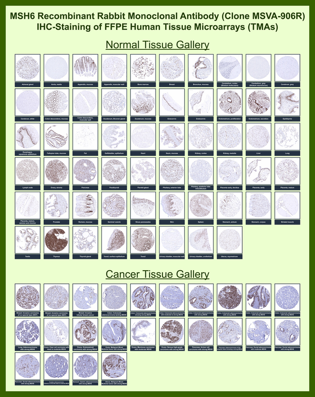MSH6 (DNA Mismatch Repair Protein) Antibody in Immunohistochemistry (Paraffin) (IHC (P))