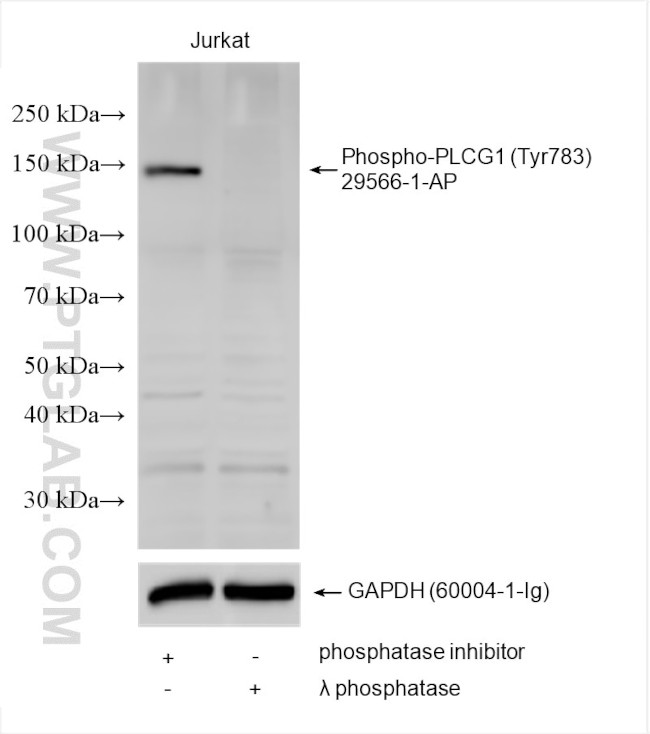 Phospho-PLCG1 (Tyr783) Antibody in Western Blot (WB)
