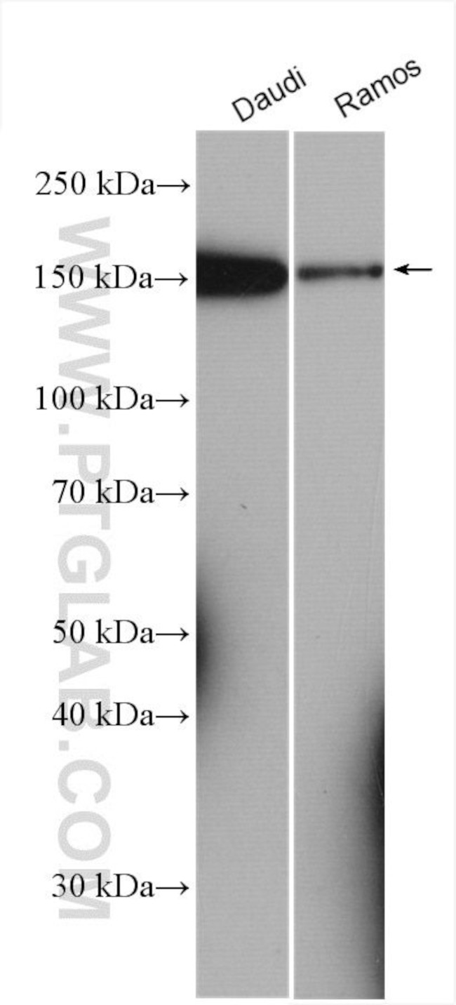 PLCG2 Antibody in Western Blot (WB)