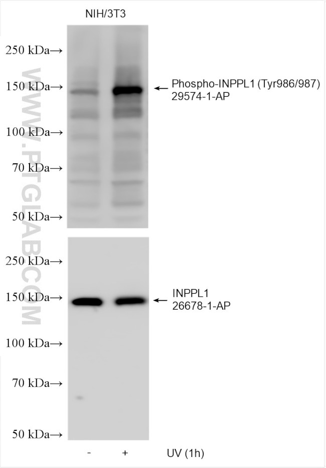 Phospho-INPPL1 (Tyr986, Tyr987) Antibody in Western Blot (WB)