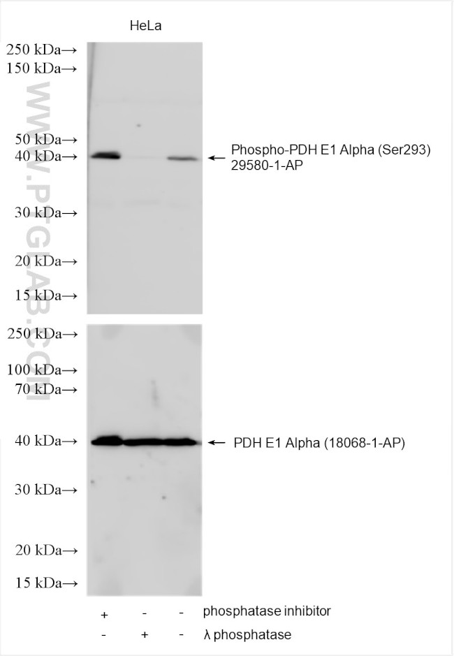 Phospho-PDH E1 Alpha (Ser293) Antibody in Western Blot (WB)