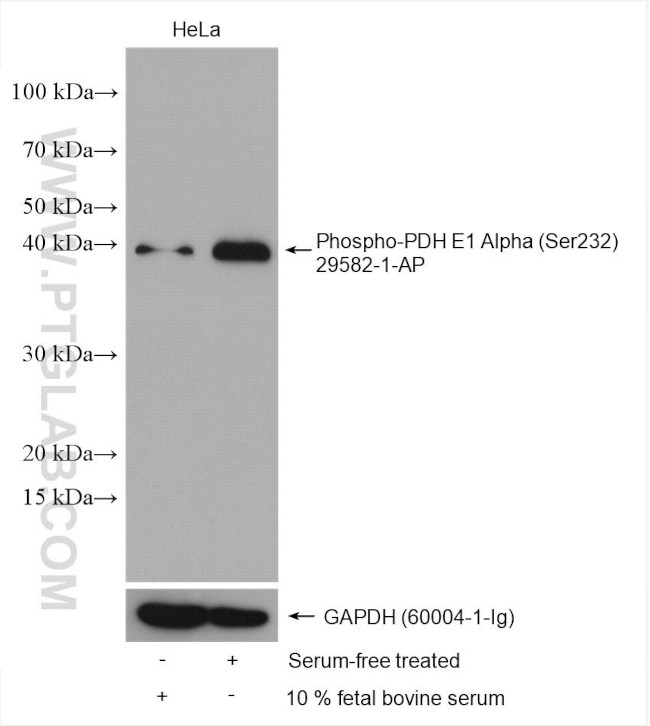 Phospho-PDH E1 Alpha (Ser232) Antibody in Western Blot (WB)