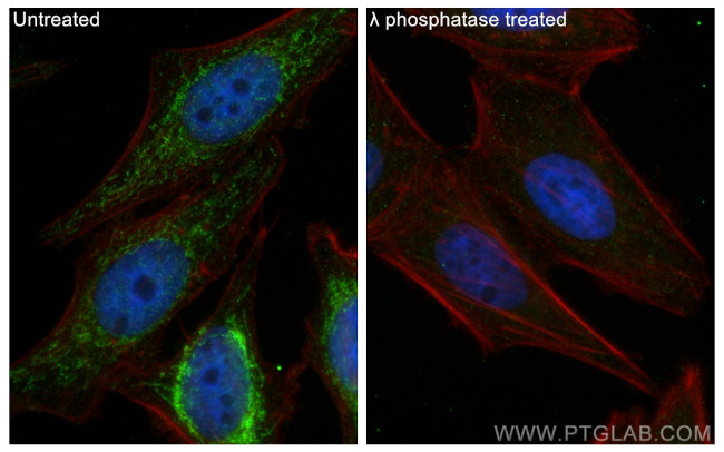 Phospho-PDH E1 Alpha (Ser300) Antibody in Immunocytochemistry (ICC/IF)