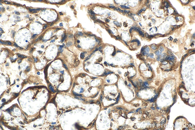 PDIA5 Antibody in Immunohistochemistry (Paraffin) (IHC (P))