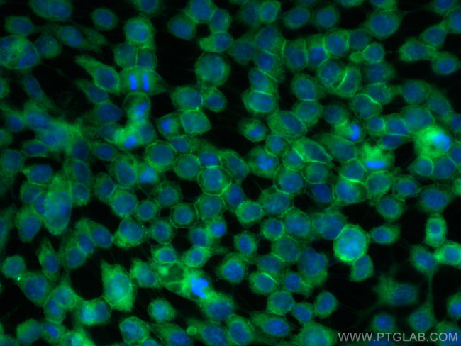 NUMB Antibody in Immunocytochemistry (ICC/IF)
