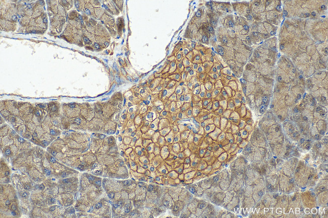 TMEM66 Antibody in Immunohistochemistry (Paraffin) (IHC (P))