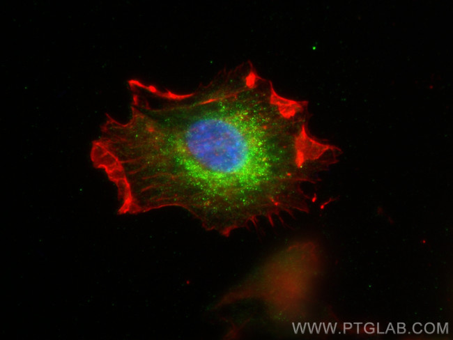 LAMTOR1 Antibody in Immunocytochemistry (ICC/IF)