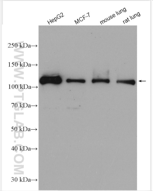 SH3BP4 Antibody in Western Blot (WB)