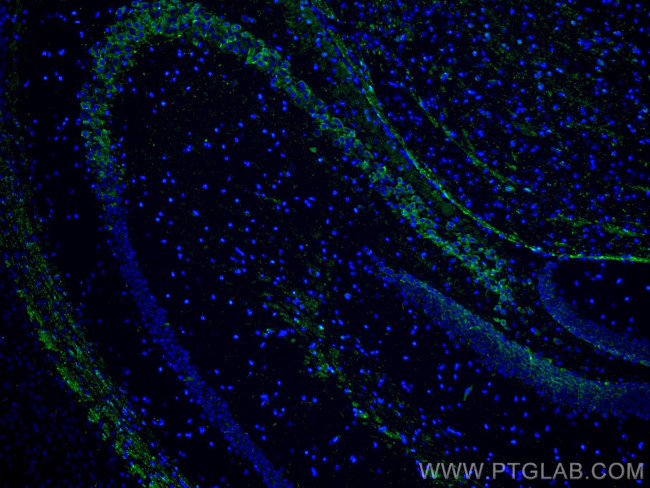 SRGAP3 Antibody in Immunohistochemistry (Paraffin) (IHC (P))