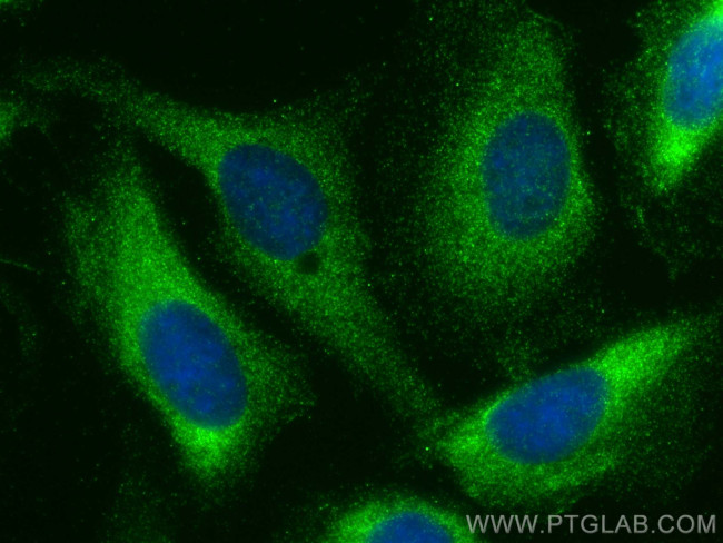 UBAP2 Antibody in Immunocytochemistry (ICC/IF)
